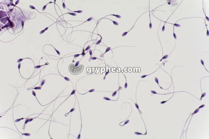 Spermatozoïdes humains x200 - gryphea.com